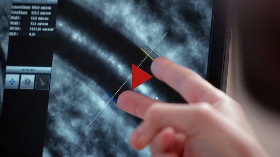 Zum Video: Prävention Augenhintergrund Zum Video: Prävention Augenhintergrund