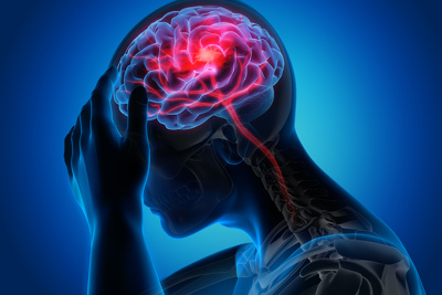 Schlaganfall-Akutbehandlung und Nachbehandlung im NEUROzentrum Dortmund