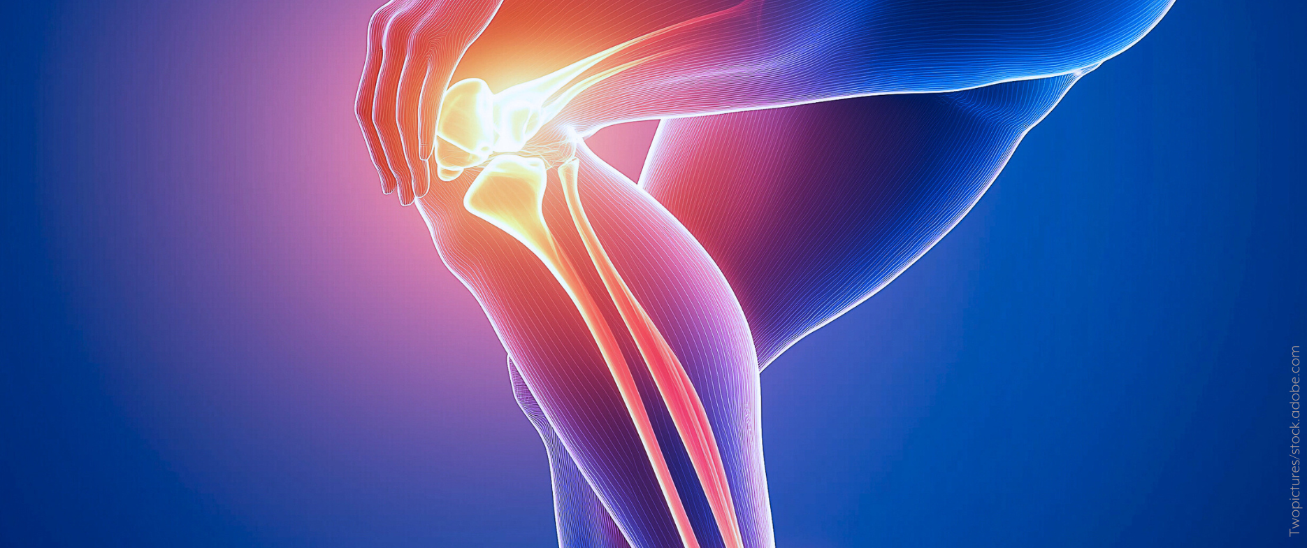 Arthrose-im-Knie-behandeln-lassen-in-der-rheumatologie-in-kamen