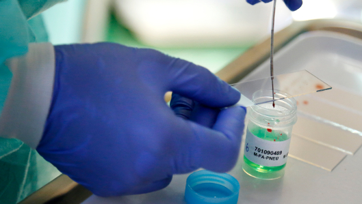 Die Klinik für Pneumologie, Schlaf- und Beatmungsmedizin am Behandlungs-zentrum Paracelsus-Klinik Marl betreut Patienten mit Erkrankungen aus dem gesamten Spektrum der Lungenheilkunde.