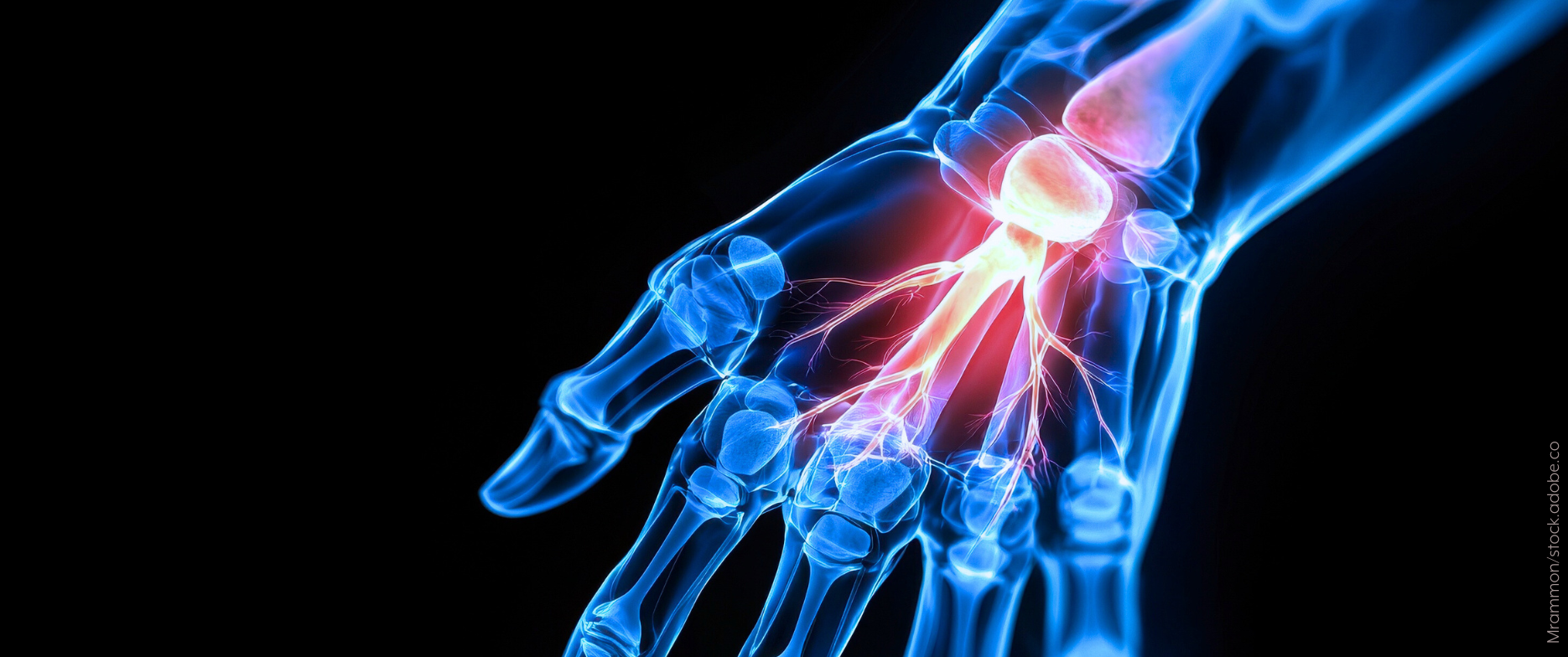 Bild-Rheumatoide-Arthritis-in-den-Knappschaft-Kliniken-Kamen