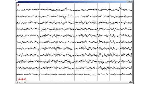EEG