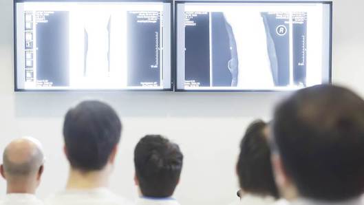 cw- und Duplexsonographie Gefäßdiagnostik