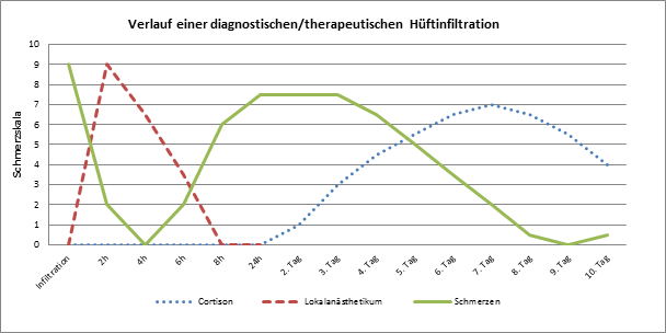 Hueftinfiltration