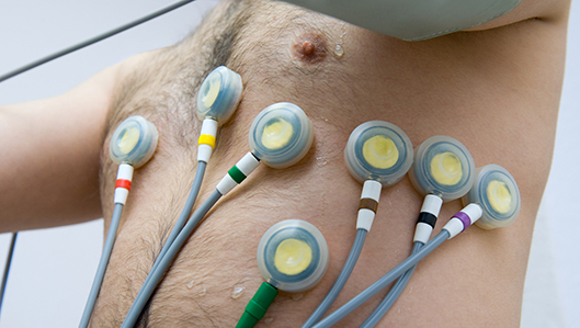 Klinik für Innere Medizin und Kardiologie