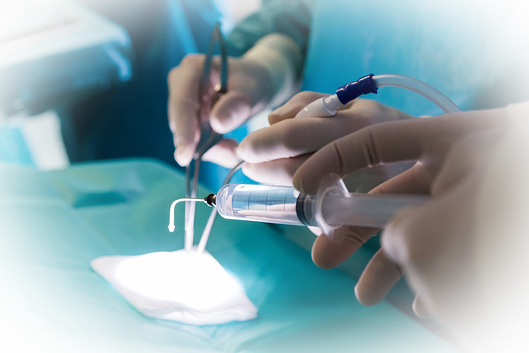 Klinik für Neurochirurgie