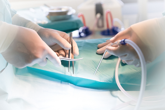 Klinik für Neurochirurgie