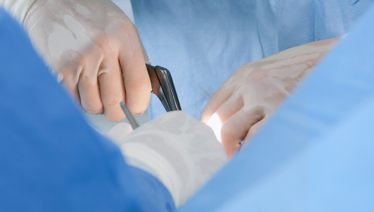 Behandlungsspektrum Neurochirurgie