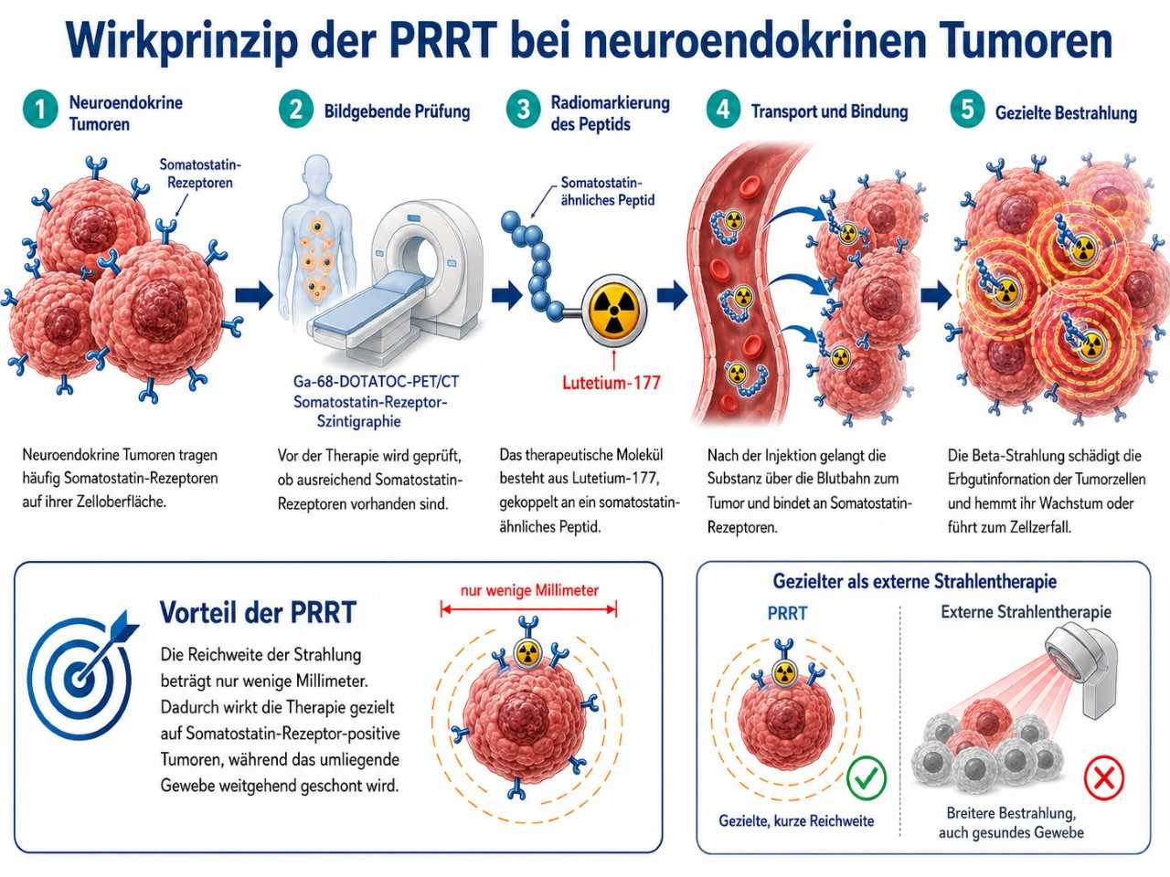 PRRT-Wirkprinzip