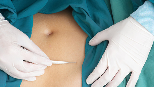 Klinik für Allgemein- und Visceralchirurgie