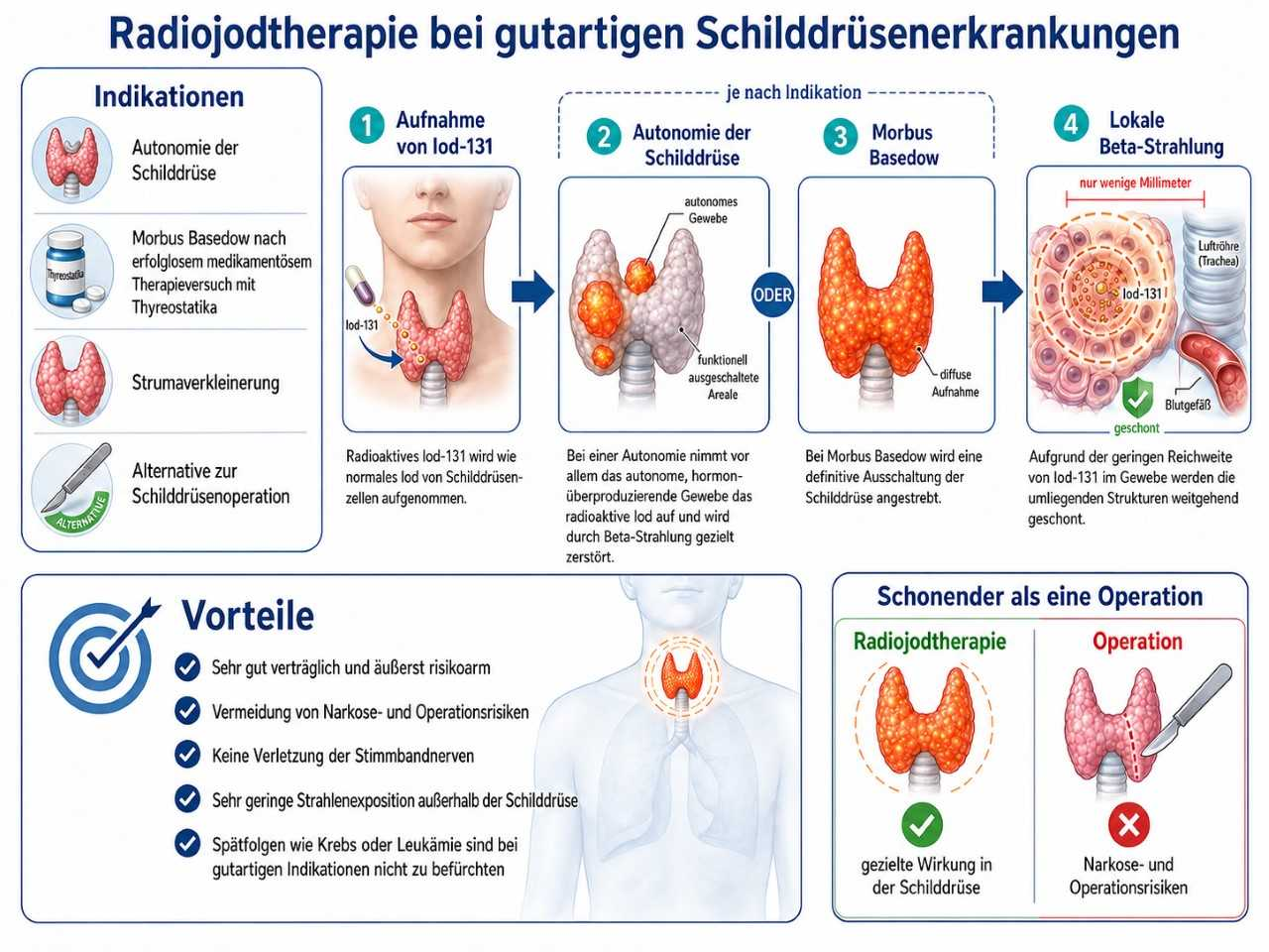 Radiojodtherapie benigne-Wirkprinzip