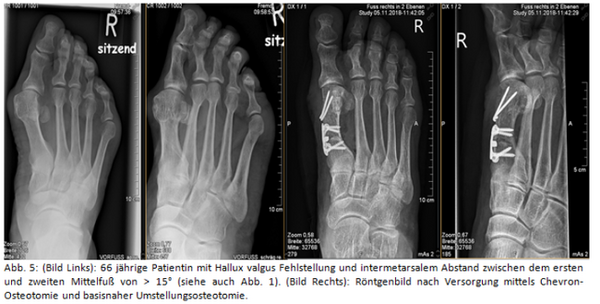 Roentgen_nach_Versorgung_75708