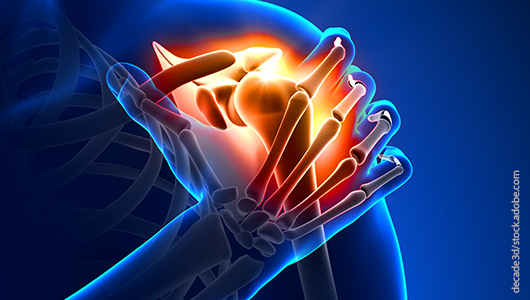 Klinik  für Orthopädie - Darstellung der Schulter
