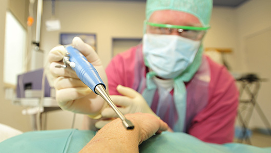 Ein Arzt in Schutzkleidung und Mundnasenschutz hält ein Instrument zur professionellen Wundreinigung in die Kamera und beugt sich dabei über einen liegenden Patienten, dessen Arm allein sichtbar ist.