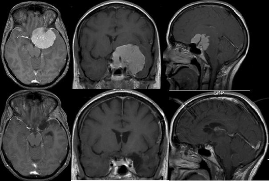 abb1_schaedelbasischirurgie1_13506