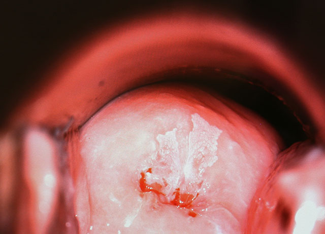 Beispiel von einem Befund