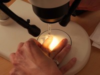 kapillarmikroskopie_44913