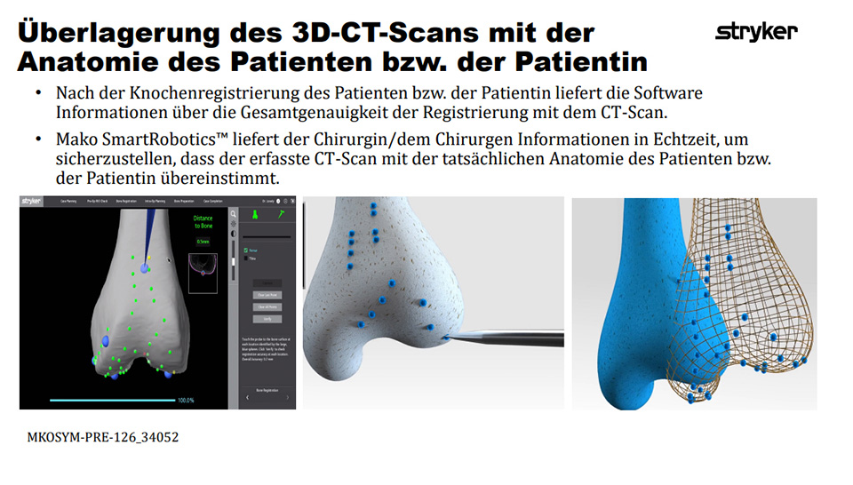 Überlagerung des 3D-CT-Scans