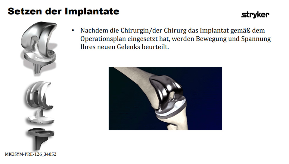 Setzen der Implantate