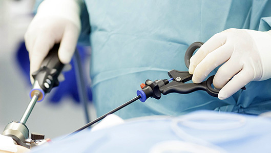 Minimal-invasive Chirurgie